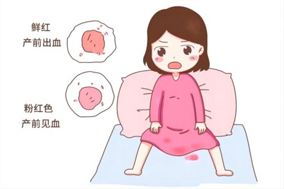 產后出血